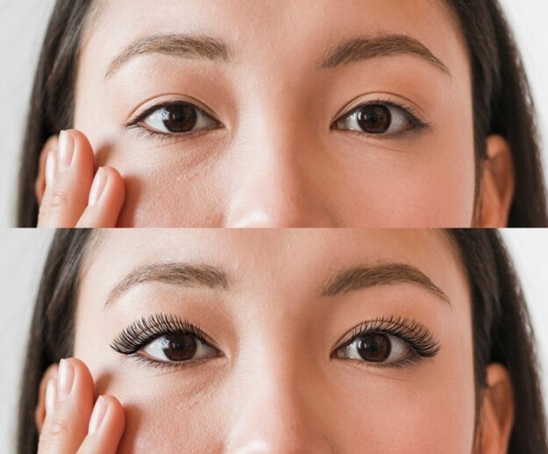 Kiểm tra kinh nghiệm chọn địa chỉ thẩm mỹ uy tín và hợp pháp