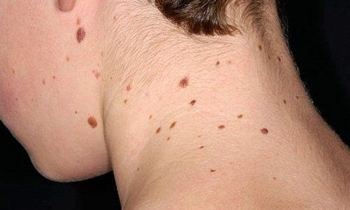 Sự tích tụ độc chất từ mỹ phẩm kém chất lượng thúc đẩy quá trình lão hóa da sớm