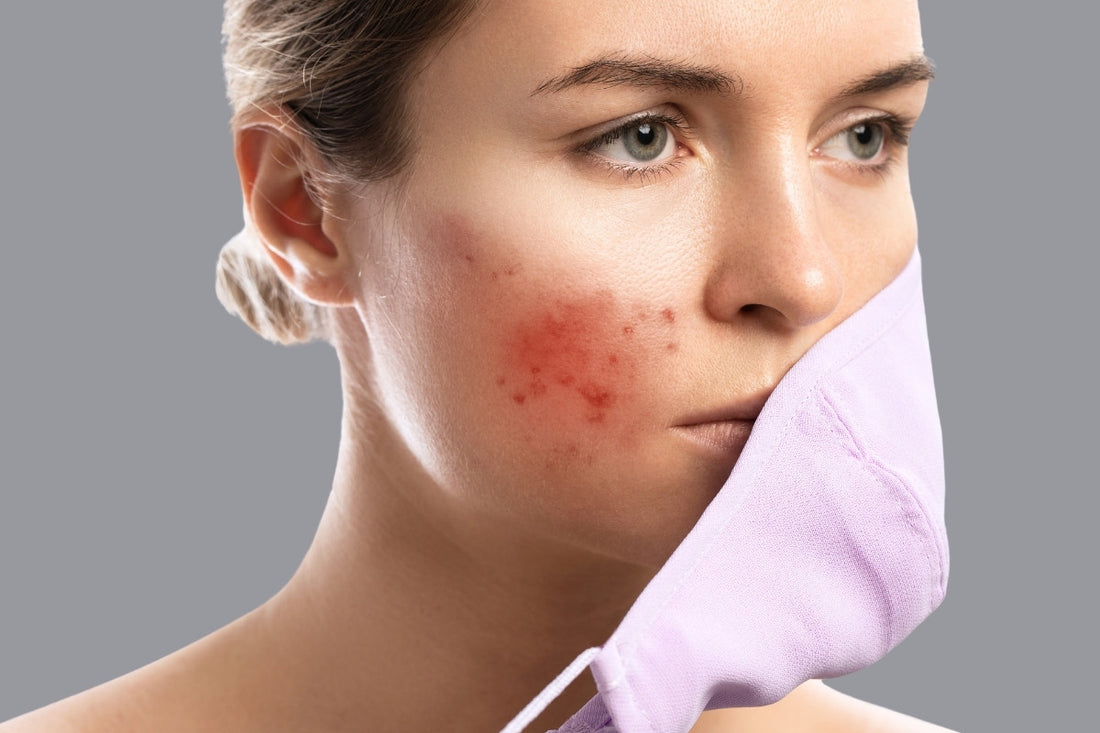 Chiến lược phục hồi da sau khi bị kích ứng hoặc quá tải treatment hiệu quả