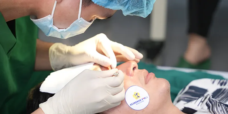 Minh họa kỹ thuật cắt da dư mí dưới an toàn