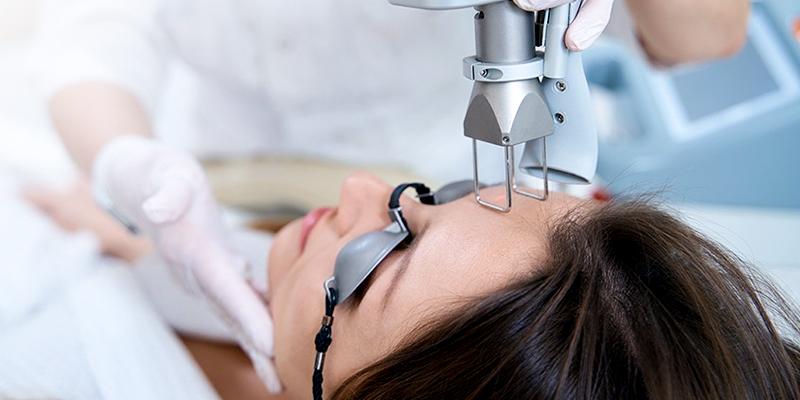 Minh họa quy trình trẻ hóa da bằng laser giúp cải thiện tình trạng sụp mí và lão hóa da
