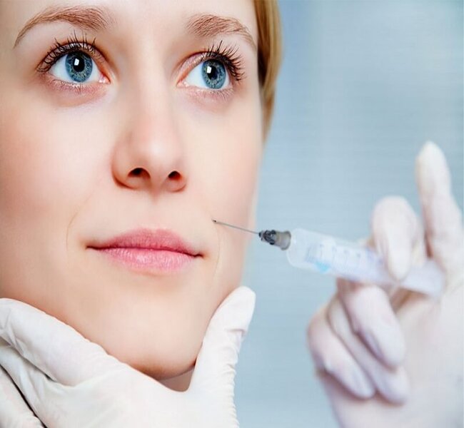 Quá trình ổn định sau khi tiêm filler rãnh cười giúp xóa mờ nếp nhăn hiệu quả.
