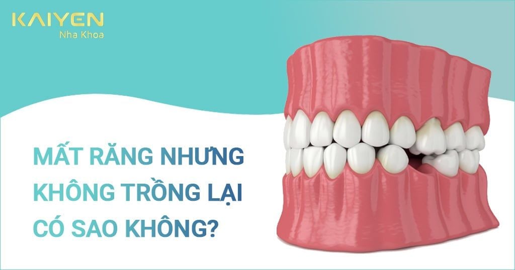 Chăm sóc sau khi độn sụn rãnh cười đúng cách để duy trì kết quả thẩm mỹ