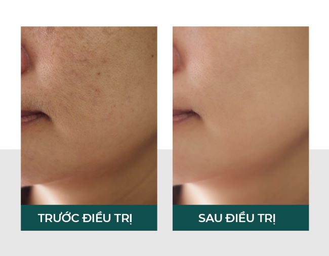 Làn da được phục hồi, căng mịn và khỏe mạnh