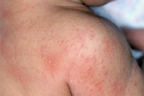 Quy trình chăm sóc da khoa học giúp GIẢM NHĂN – NÂNG CƠ hiệu quả