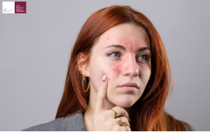 Môi trường không khí trong nhà có chứa nhiều hạt bụi mịn gây stress oxy hóa