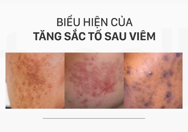 Minh họa quy trình phục hồi da bằng phương pháp tái cấu trúc sinh học