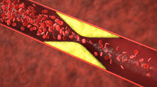 Quy trình chuyển hóa lipid trong gan và vai trò của thảo dược trong việc hỗ trợ đào thải mỡ thừa