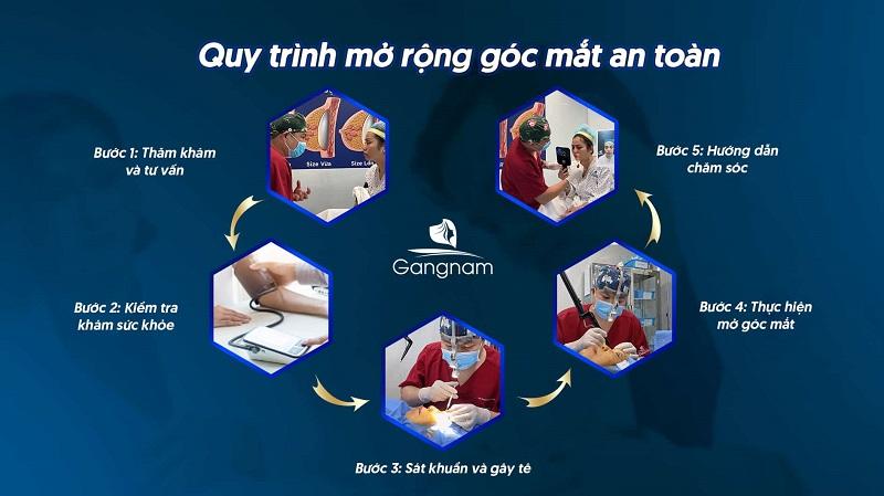 Quy trình thực hiện phẫu thuật tạo hình mắt chuẩn y khoa tại Hana Premium Beauty Center