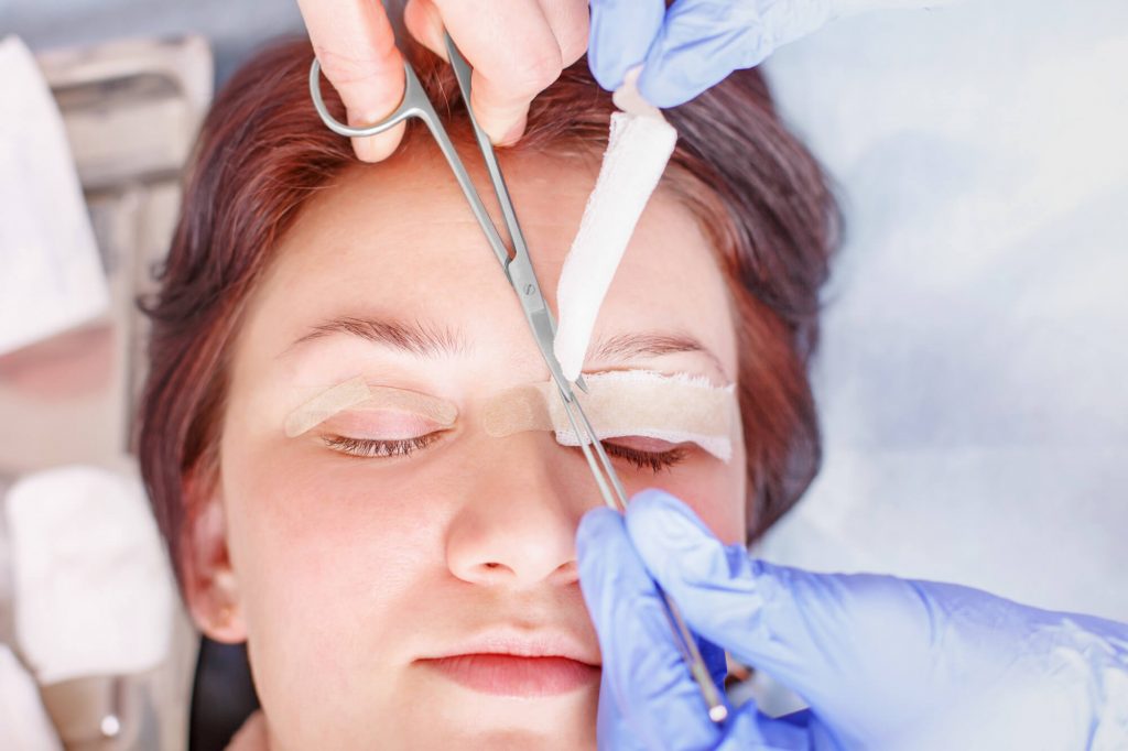 Phẫu thuật nâng mí mắt điều trị sụp mí nặng và lão hóa vùng mắt