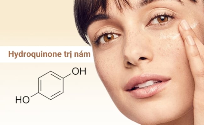 Chăm sóc da nám chuyên sâu bằng cách chống nắng và bảo vệ hàng rào da