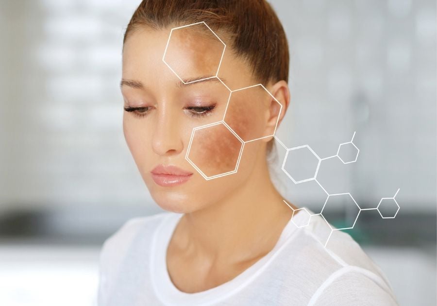 Nghiên cứu so sánh làn da trước và sau sử dụng Niacinamide