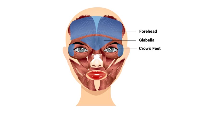 FDA-Approved Sites for Botox Cosmetic
