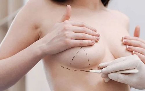 Bác sĩ gây mê hồi sức chuẩn bị kỹ lưỡng cho ca phẫu thuật thẩm mỹ an toàn