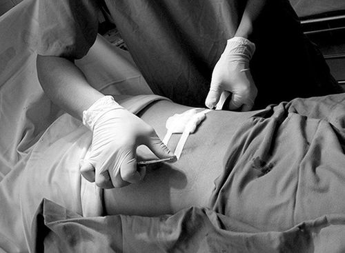 Chăm sóc hậu phẫu tại phòng hồi sức tích cực đảm bảo sức khỏe ổn định