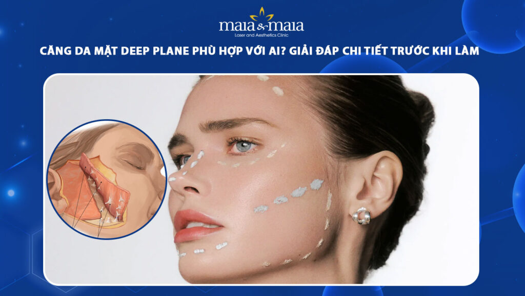 Cơ chế nâng đỡ tự nhiên từ sâu bên trong của phương pháp căng da mặt Deep Plane cho nam giới