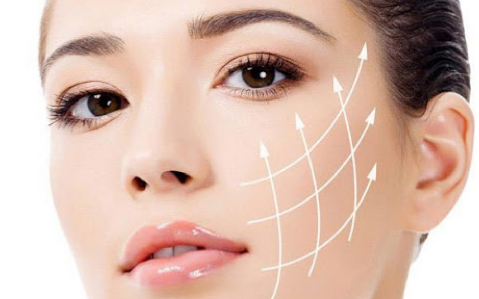 So sánh chỉ không tiêu và các phương pháp căng da mặt chỉ phổ biến