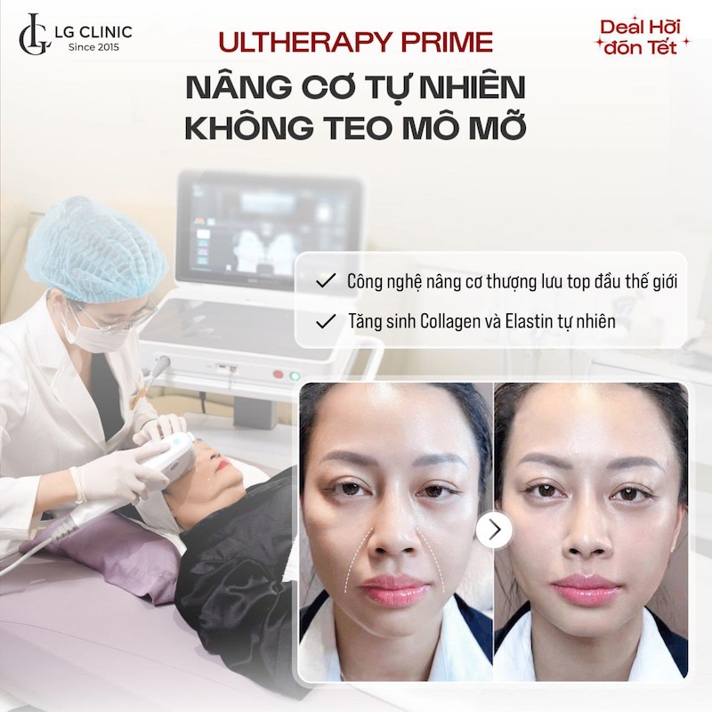 Các công nghệ nâng cơ mặt giúp khắc phục sụp mí hiệu quả