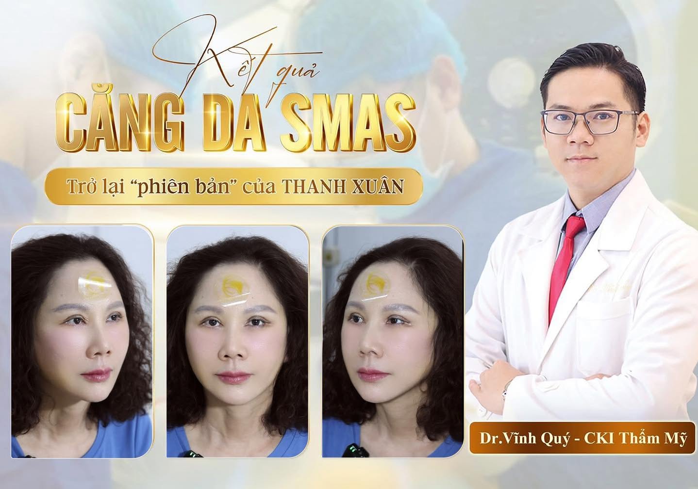Bác sĩ Hana Premium Beauty tư vấn phương pháp khắc phục rãnh cười sâu