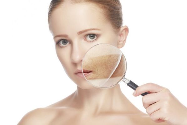 Cơ chế tác động của Tranexamic Acid trong điều trị nám