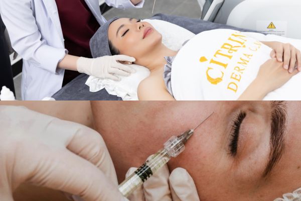 Phác đồ điều trị nám cá nhân hóa giúp duy trì kết quả bền vững lâu dài