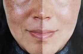 Phụ nữ lo lắng vì da không cải thiện, cần đánh giá lại routine và cách theo dõi quá trình skincare.