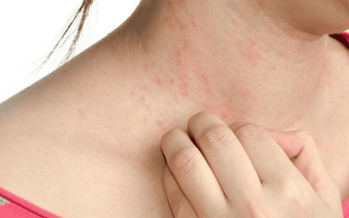 Trẻ 10 tuổi cần được hướng dẫn cách vệ sinh da mặt đúng để hạn chế mụn