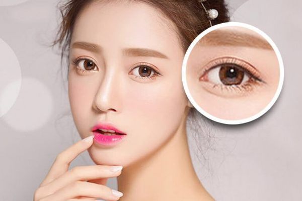 Lịch trình phục hồi mí mắt sau cắt, giảm sưng và quay lại làm việc bình thường