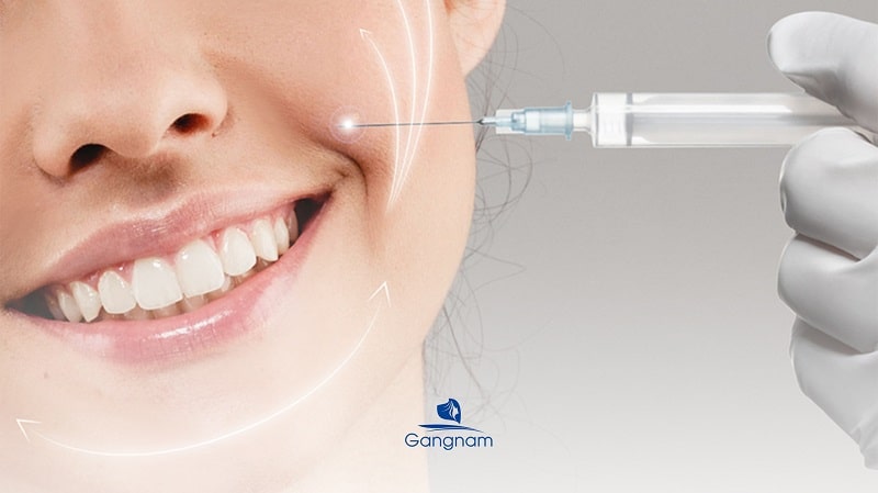 Bác sĩ thực hiện quy trình tiêm filler rãnh cười an toàn chuẩn y khoa