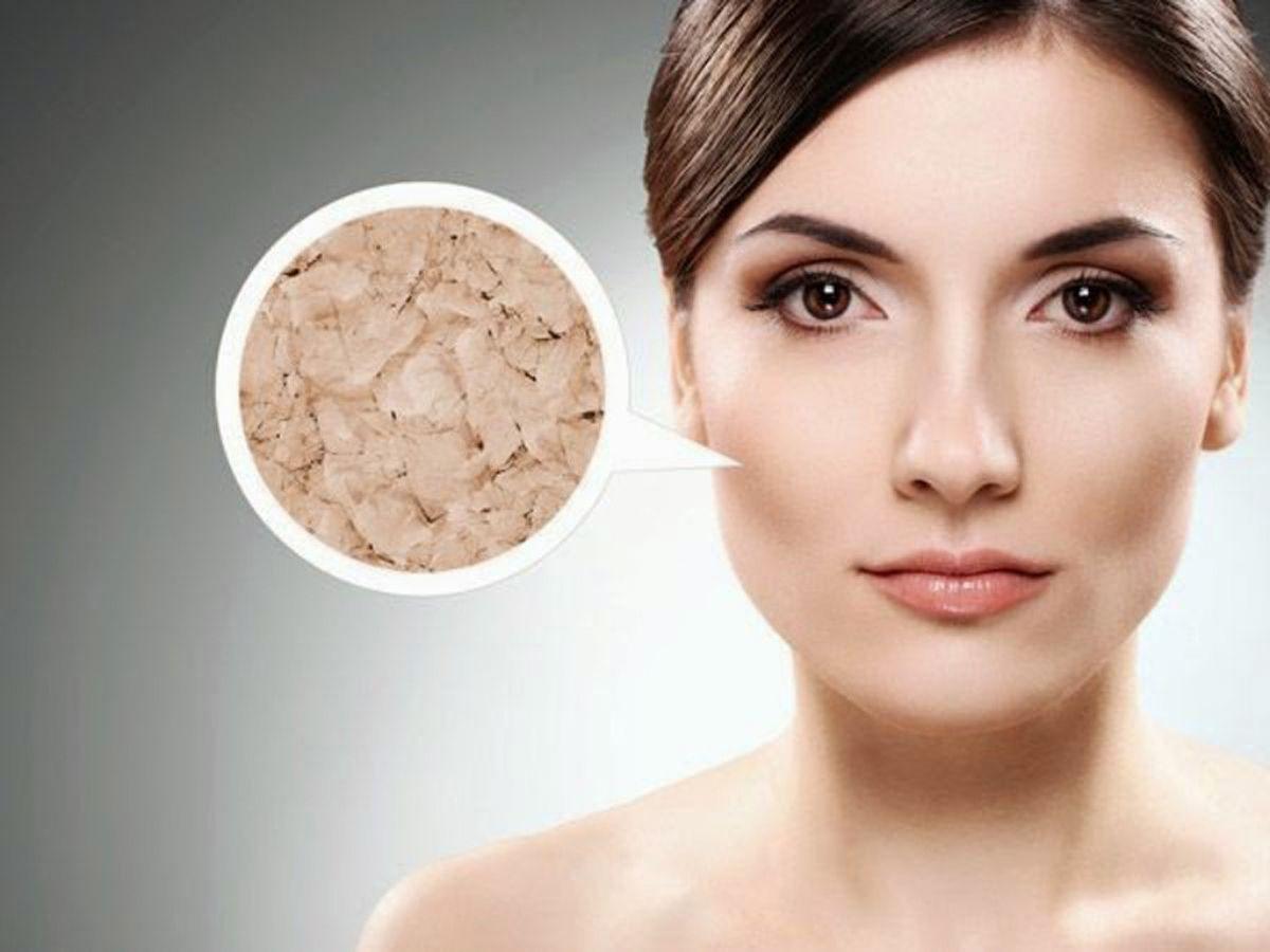 Làn da thiếu ẩm do sai lầm chăm sóc làm giảm hiệu quả mỹ phẩm