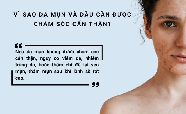 Quy trình chăm sóc da mụn mùa nóng đúng chuẩn khoa học