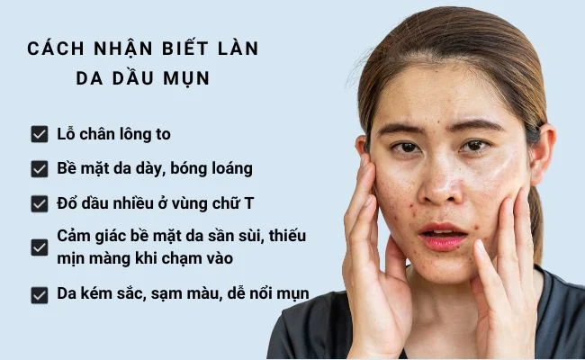 Skincare khoa học cho da mụn tuổi dậy thì mùa nóng