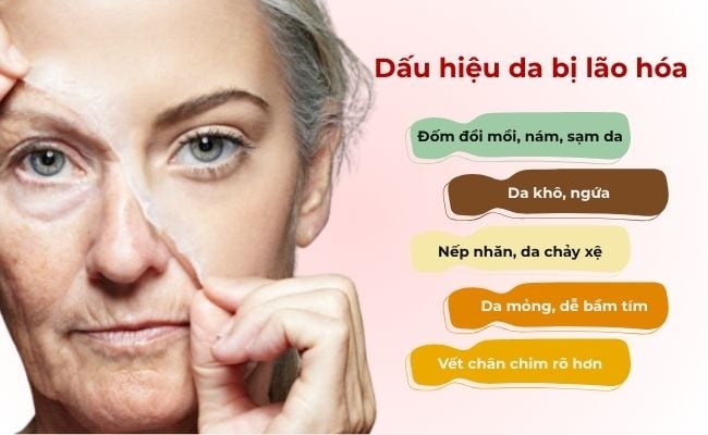 Màng bảo vệ da bị tổn thương nghiêm trọng do sử dụng mỹ phẩm chứa chất tẩy rửa mạnh.