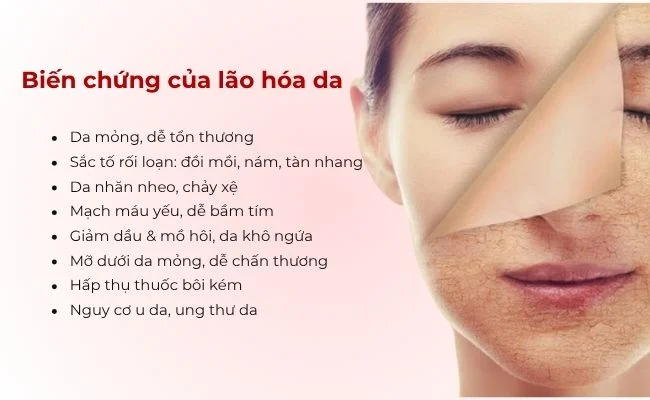 Làn da mỏng manh và xuất hiện nếp nhăn sớm khi lớp lipid biểu bì suy giảm chức năng.