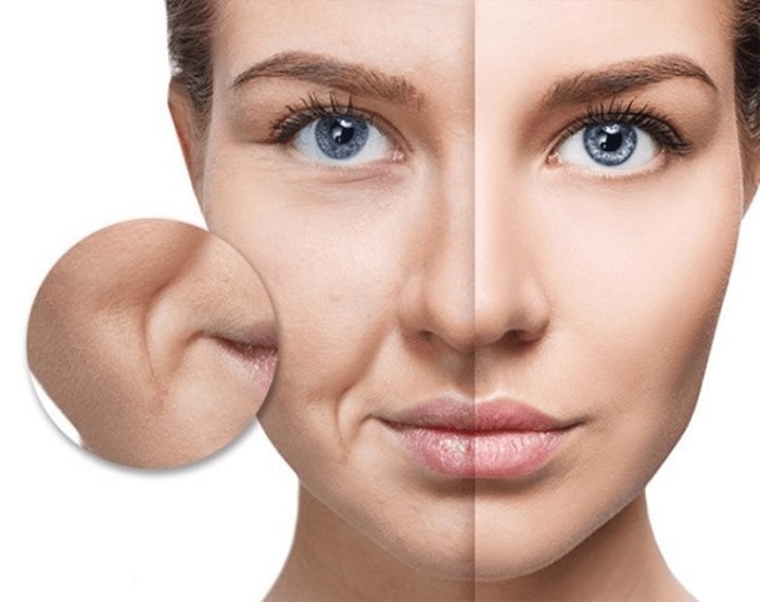 Cấu trúc da và sự mất collagen vùng rãnh cười