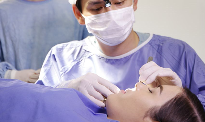 Các loại sụn mũi dùng trong nâng mũi