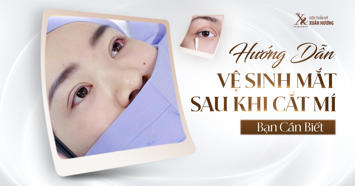 Hướng dẫn vệ sinh vết khâu cắt da dư mí dưới một cách an toàn và nhẹ nhàng