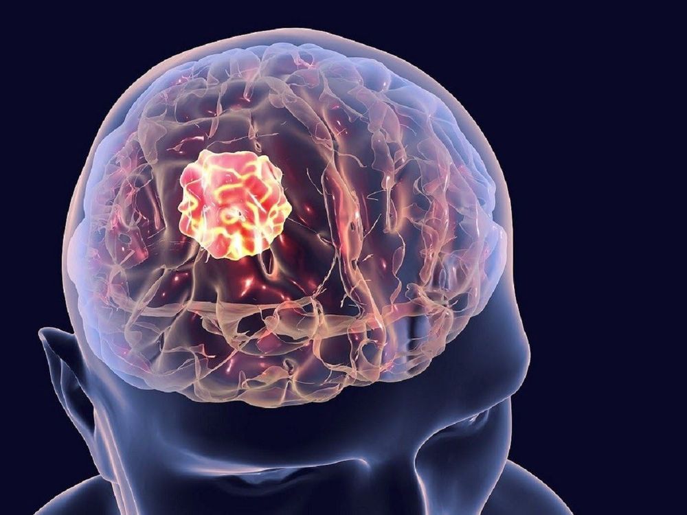 Nhận biết dấu hiệu cảnh báo nguy hiểm sau phẫu thuật nâng cung chân mày