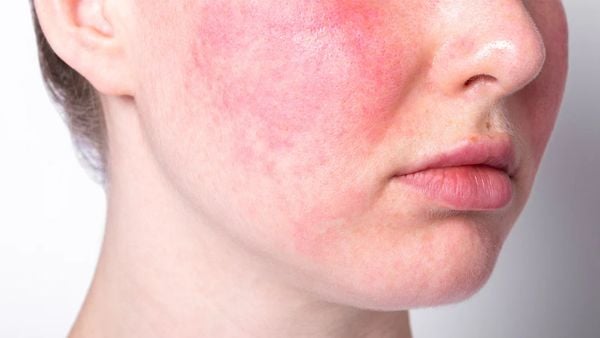 Quy trình phục hồi hàng rào bảo vệ da tại nhà