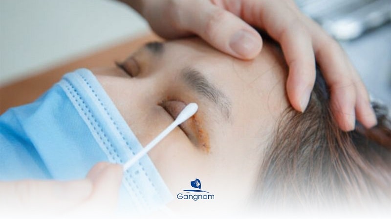 Quy trình thực hiện nhấn mí Plasma an toàn