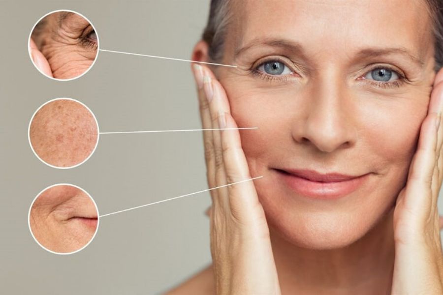Minh họa các loại nếp nhăn và cấu trúc da mỏng manh quanh mắt