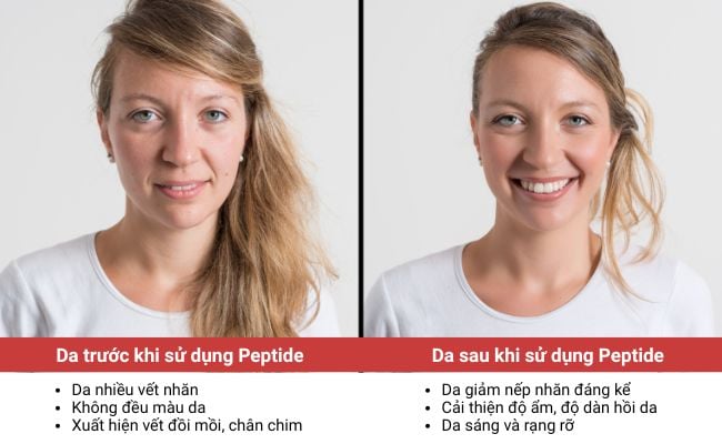 Sự kết hợp giữa công nghệ peptide và liệu trình thẩm mỹ giúp tối ưu hiệu quả GIẢM NHĂN – NÂNG CƠ