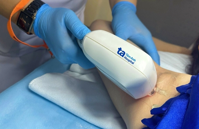 Cấu trúc lông mọc ngược gây viêm nang lông