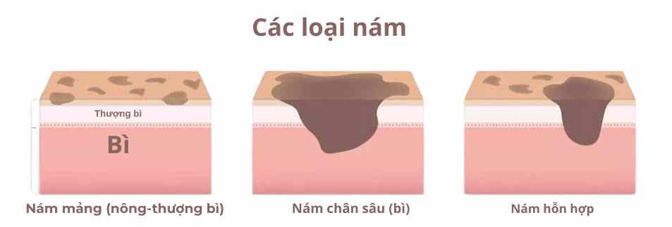 Các tác nhân lối sống ảnh hưởng đến sự hình thành và điều trị nám da