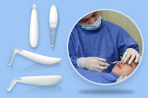 Sụn nhân tạo được sử dụng trong nâng mũi có thể đa dạng về hình dáng, phù hợp cho việc tạo sống mũi cao và thẳng