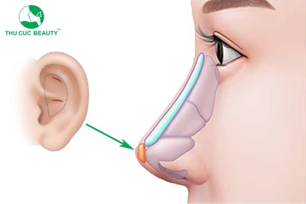 Minh họa sự tích hợp của sụn trong cấu trúc cằm giúp duy trì dáng cằm ổn định