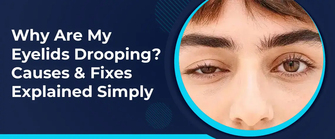 Hình ảnh cận cảnh mí mắt bị sụp do lão hóa hoặc cơ nâng mi yếu, minh họa tình trạng sụp mí mắt thực sự.