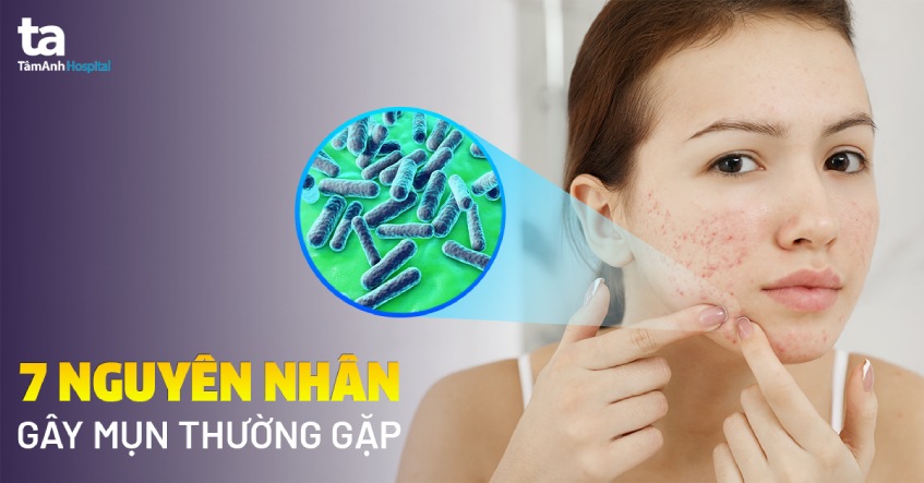Da mụn và cách xử lý vào mùa nóng: Bí quyết phục hồi