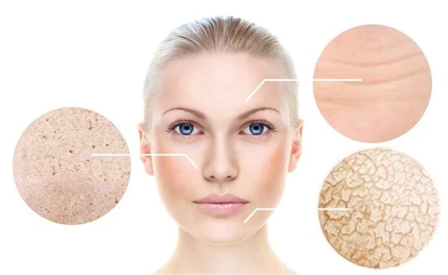 Điều hòa văn phòng: Kẻ thù thầm lặng của da khô