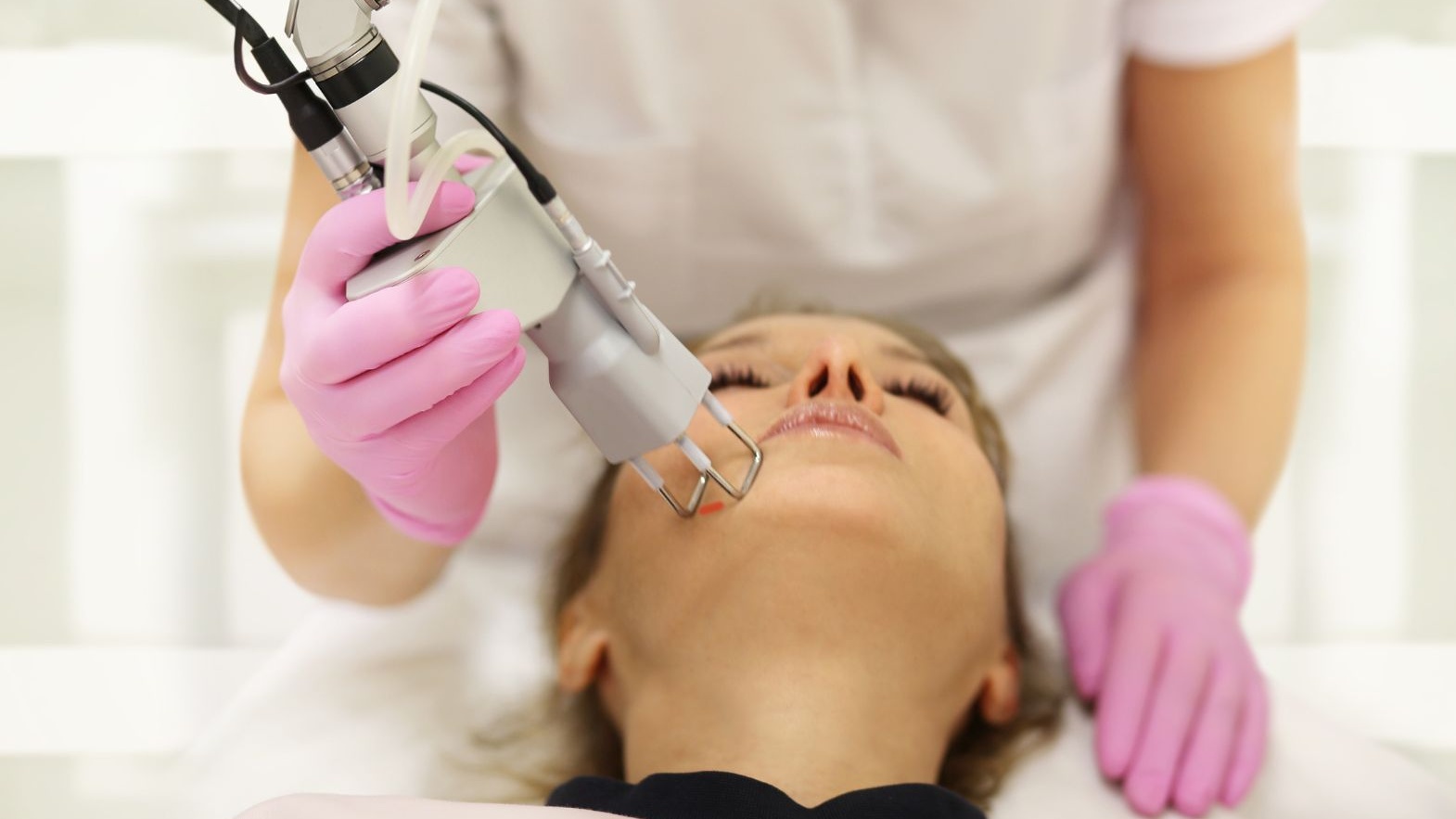 Sau laser bao lâu dùng được Vitamin C? Cách kiểm tra da
